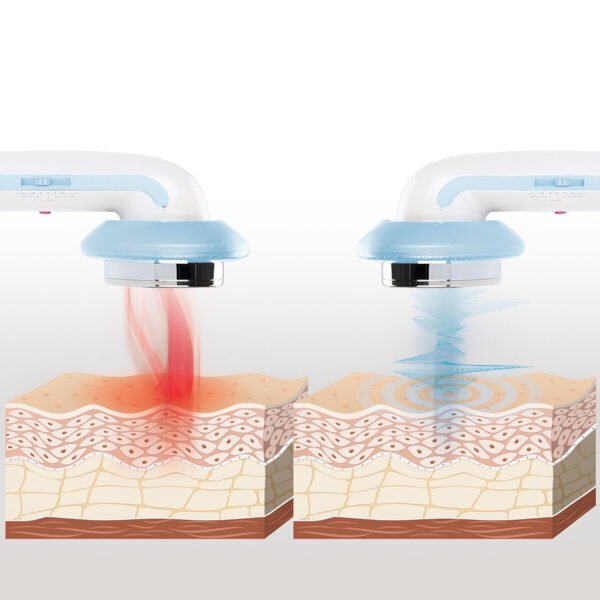 3-In-1 Ultrasone Cavitatie Anti-Cellulitisstimulator Met Infrarood En Elektrostimulatie "Cellymax" - Afbeelding 7